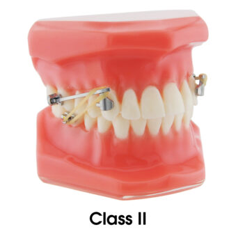 p00031 zero corrector class II typodont R